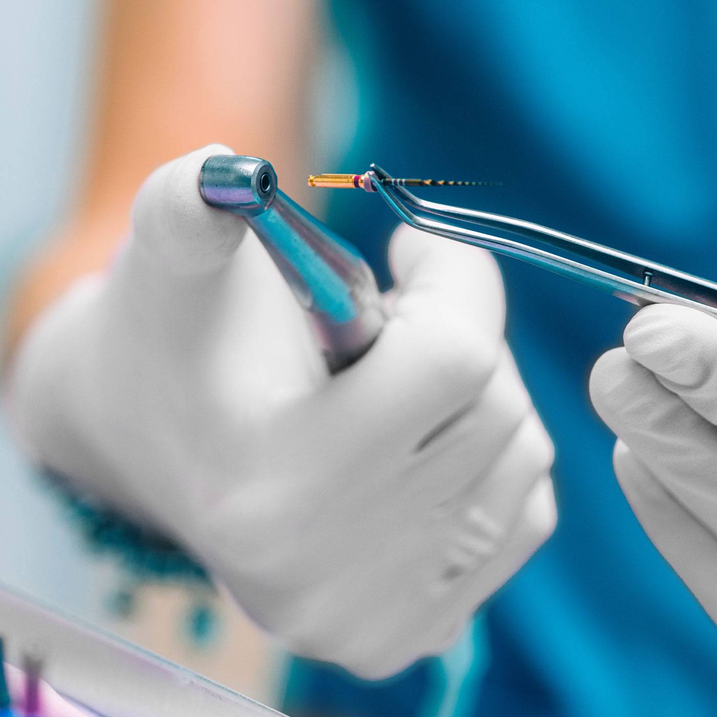 Medical-san-giorgio-dentista-cantu-Odontoiatria-conservativa-endodonzia