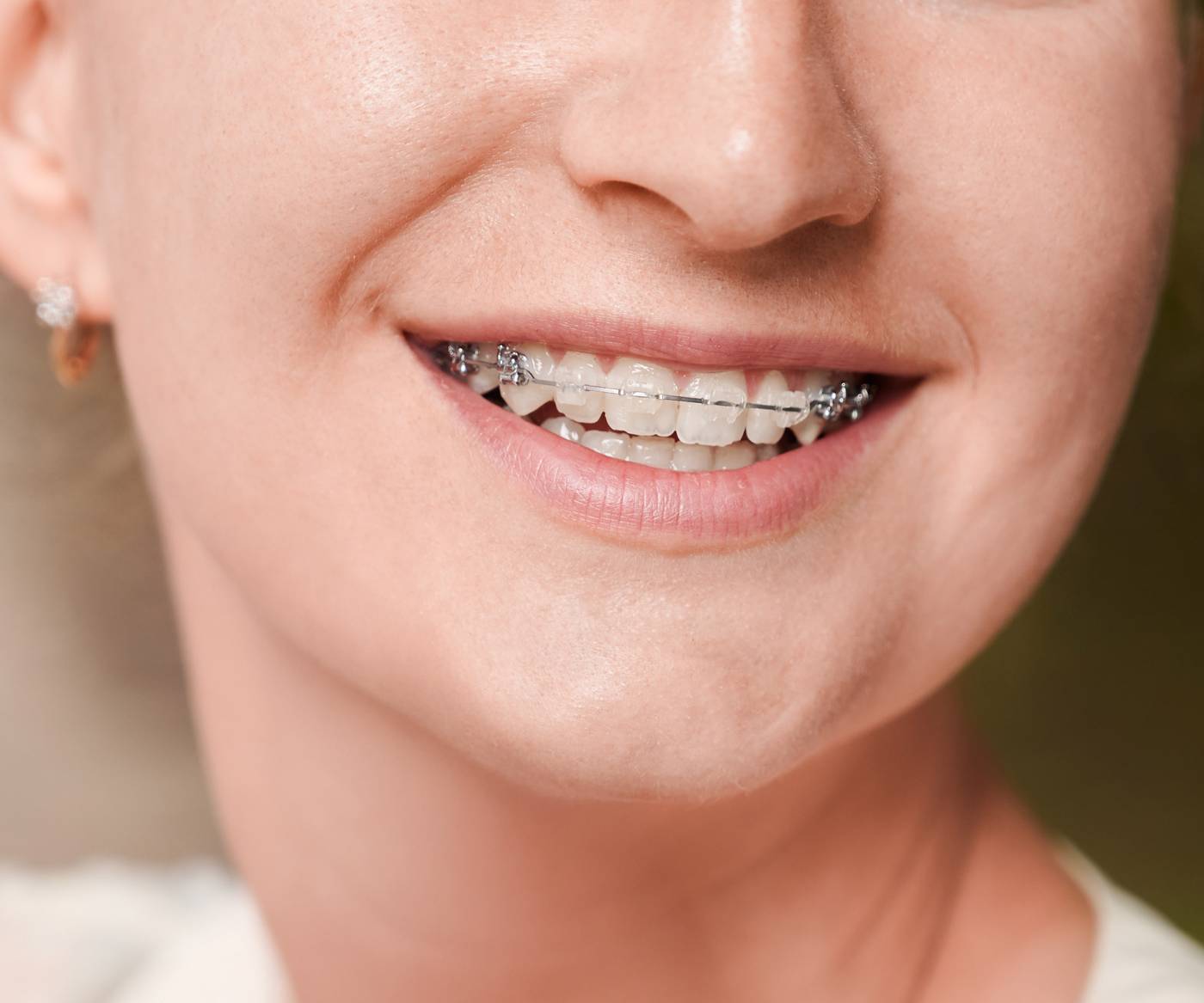 Medical-san-giorgio-dentista-cantu-ortodonzia-fissa