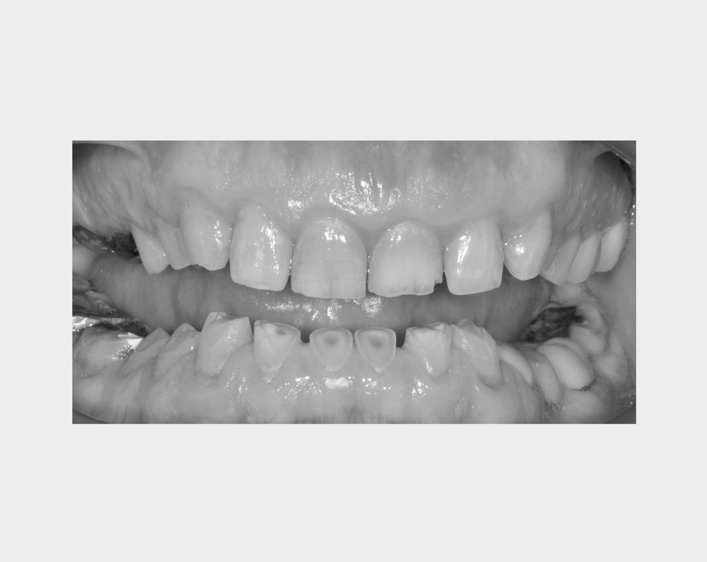 Medical-san-giorgio-dentista-molteni-cantu-gnatologia-bruxismo-3