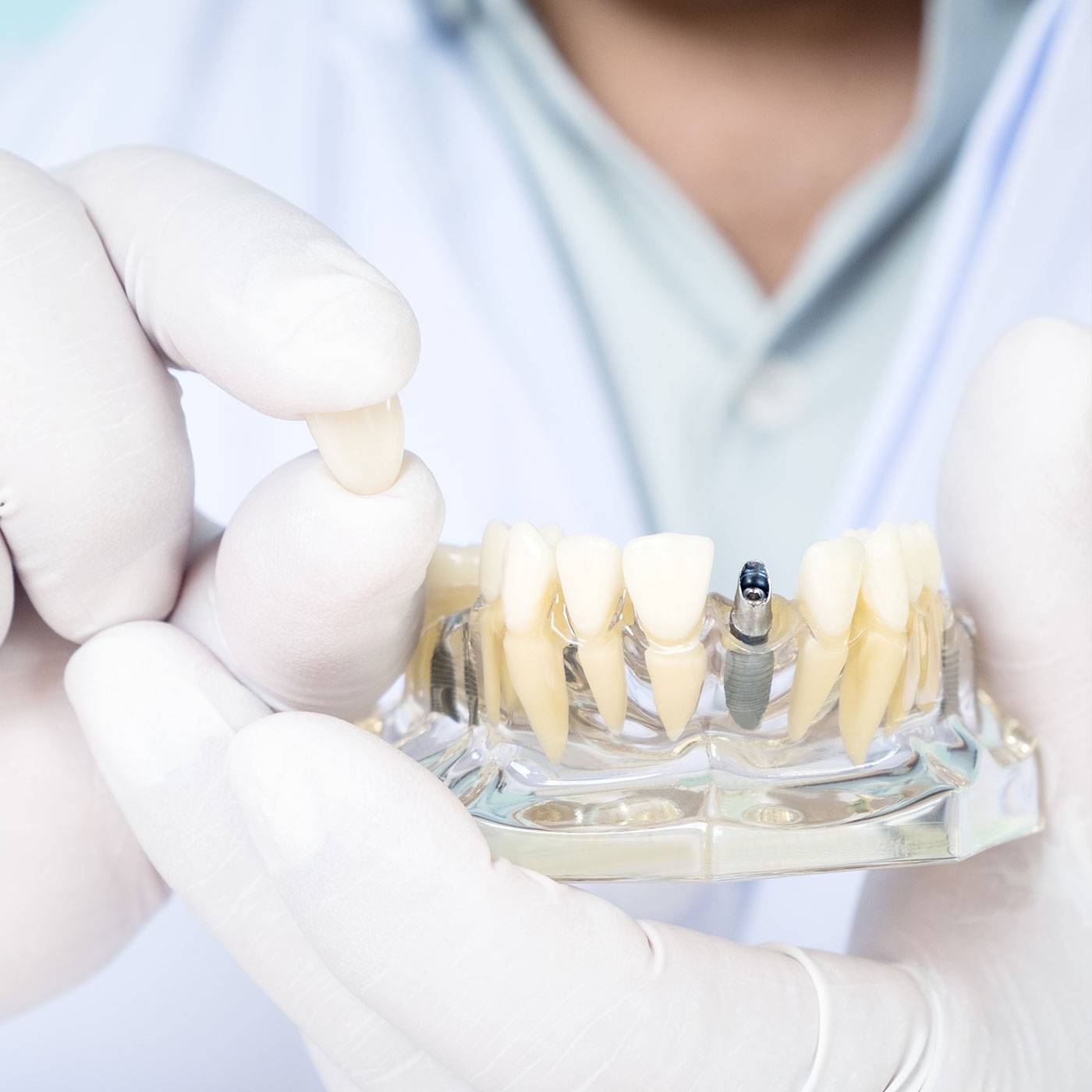 Medical-san-giorgio-dentista-cant&ugrave;-Chirurgia-implantologia