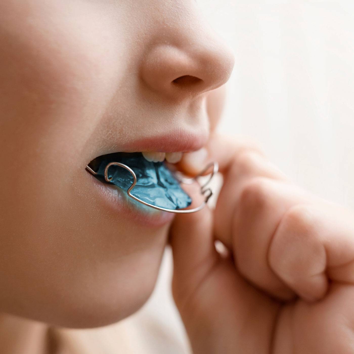 Medical-san-giorgio-dentista-cantu-ortodonzia-intercettiva-apparecchio