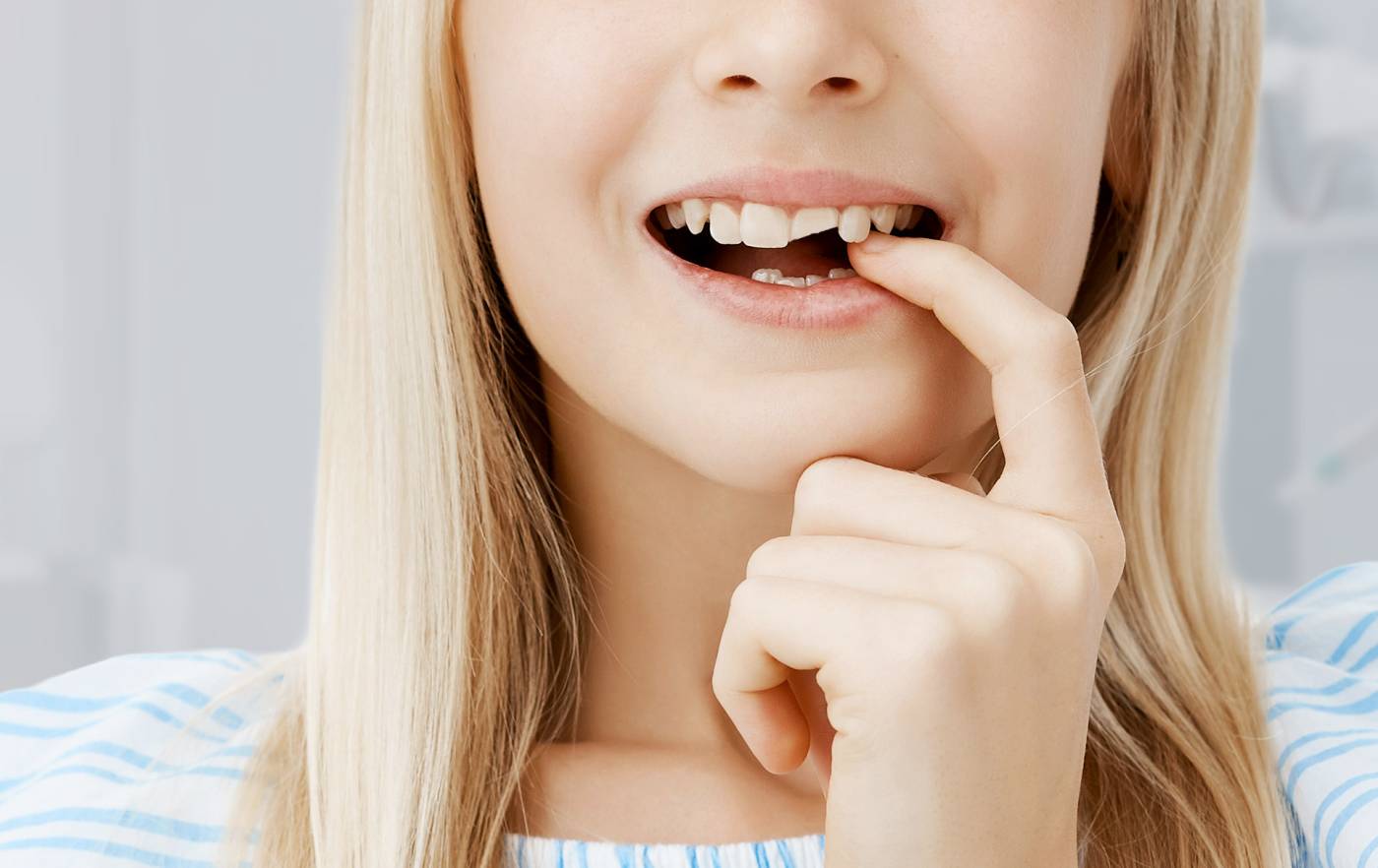 Medical-san-giorgio-dentista-cantu-trauma-dentale-infantile-1