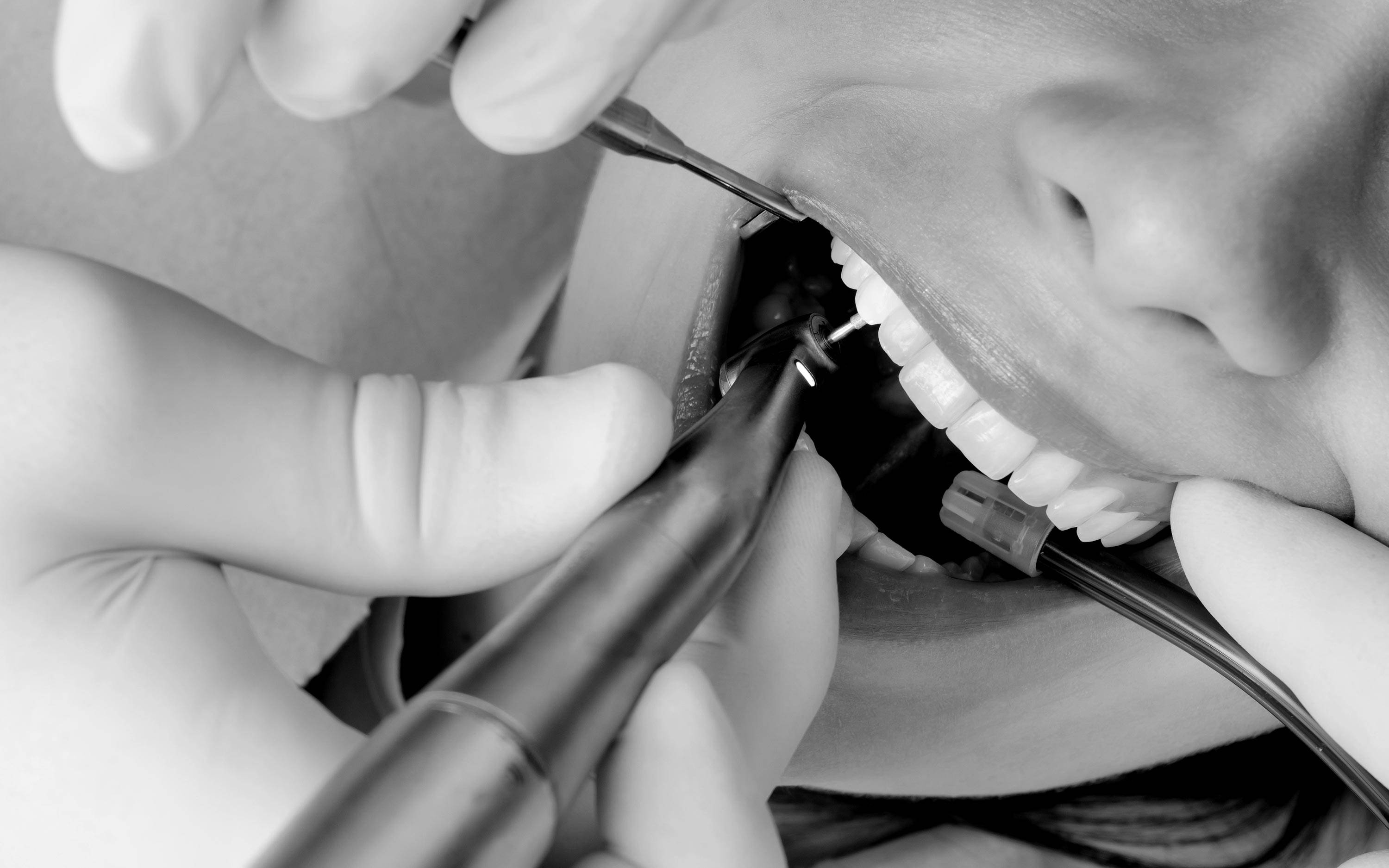 Medical-san-giorgio-dentista-molteni-cantu-Odontoiatria-conservativa-slider